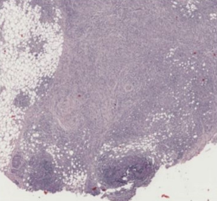 Standard H&E stained whole-slide image before analysis