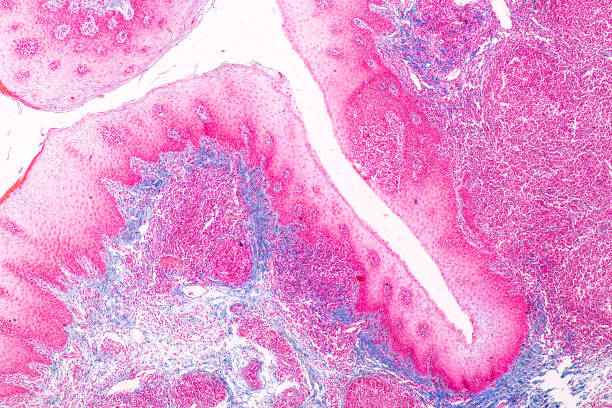 Archival cancer tissue samples used for biopharma screening