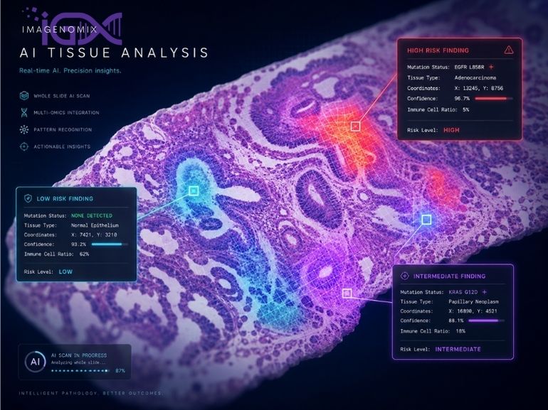 Imagenomix AI custom model development