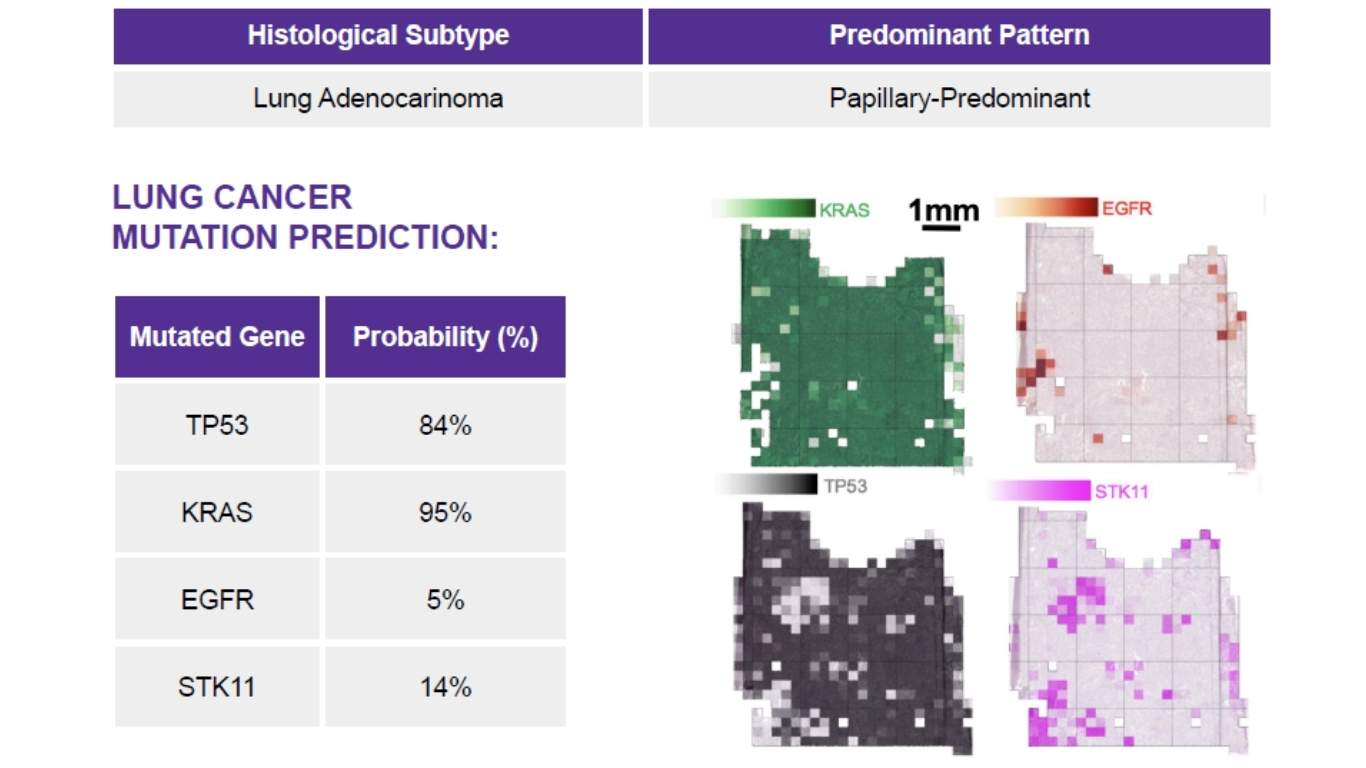 Predicted mutation map from an H&E slide